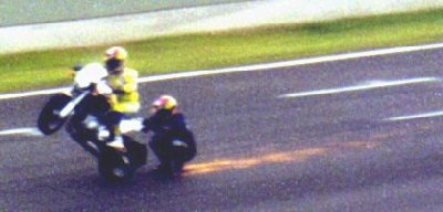 Hornhautentfernung 2